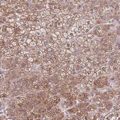 Immunohistochemistry-Paraffin: NTPCR Antibody [NBP2-38724]