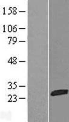 Western Blot: NTPCR Overexpression Lysate [NBL1-08324]