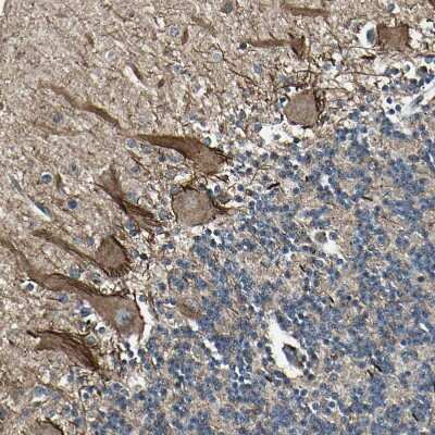 Immunohistochemistry-Paraffin: NUAK2 Antibody [NBP1-81880]