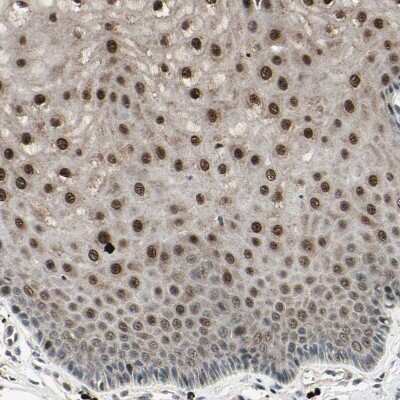 Immunohistochemistry-Paraffin: NUAK2 Antibody [NBP1-81880]