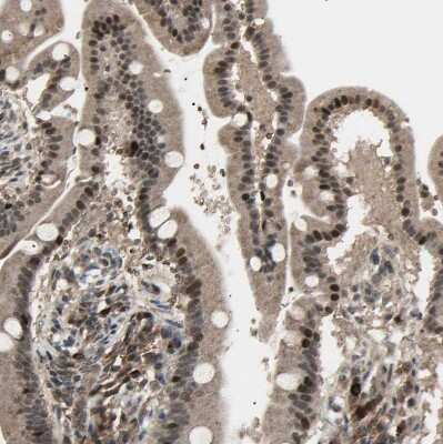 Immunohistochemistry-Paraffin: NUAK2 Antibody [NBP1-81880]
