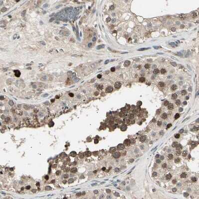 Immunohistochemistry-Paraffin: NUAK2 Antibody [NBP1-81880]