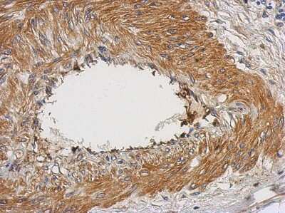 Immunohistochemistry-Paraffin: NUAK2 Antibody [NBP2-19599]