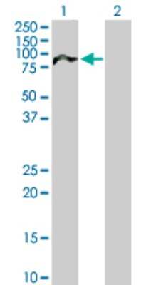 Western Blot: NUAK2 Antibody [H00081788-B01P]