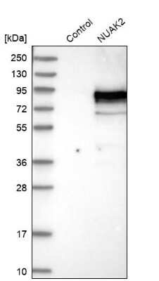 Western Blot: NUAK2 Antibody [NBP1-81880]