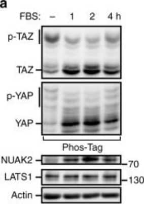 Western Blot: NUAK2 Antibody [NBP1-81880]