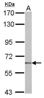 Western Blot: NUAK2 Antibody [NBP2-19599]