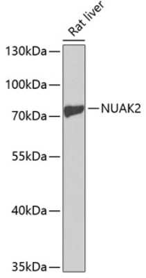 Western Blot: NUAK2 AntibodyBSA Free [NBP2-94277]