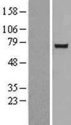 Western Blot: NUAK2 Overexpression Lysate [NBL1-13844]