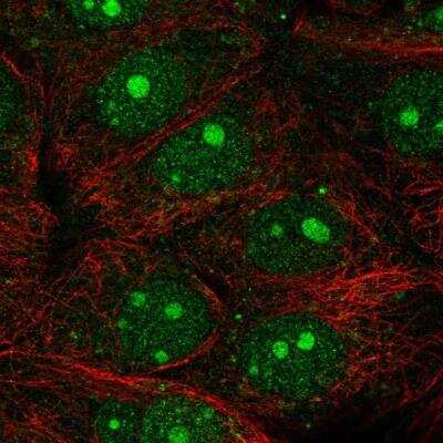 Immunocytochemistry/ Immunofluorescence: NUB1/NYREN18 Antibody [NBP2-54738]