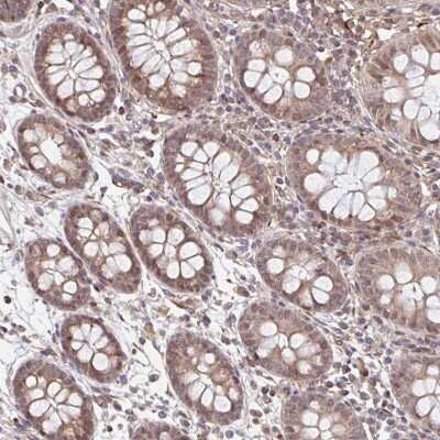 Immunohistochemistry: NUB1/NYREN18 Antibody [NBP2-48553]