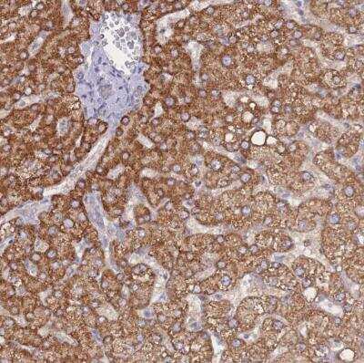 Immunohistochemistry-Paraffin: NUB1/NYREN18 Antibody [NBP2-54738]