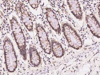 Immunohistochemistry-Paraffin: NUB1/NYREN18 Antibody [NBP2-97440]