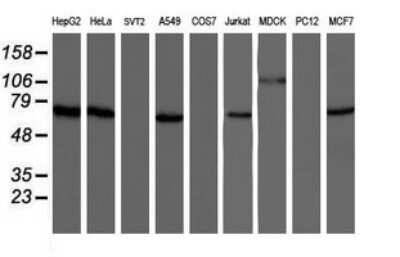 Western Blot: NUB1/NYREN18 Antibody (OTI2G1)Azide and BSA Free [NBP2-73082]