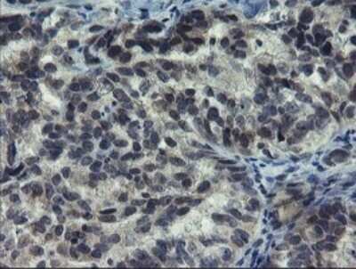 Immunohistochemistry: NUB1/NYREN18 Antibody (OTI2G1) [NBP2-46267]