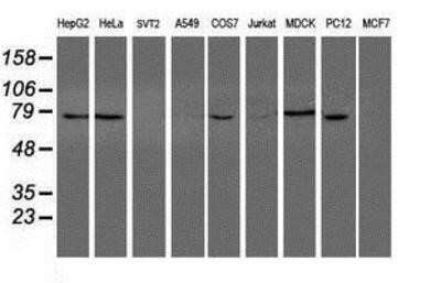 Western Blot: NUB1/NYREN18 Antibody (OTI4H2)Azide and BSA Free [NBP2-73084]