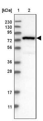 Western Blot: NUB1/NYREN18 Antibody [NBP2-48553]