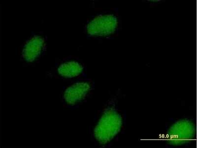 Immunocytochemistry/ Immunofluorescence: NUBP1 Antibody [H00004682-B01P]
