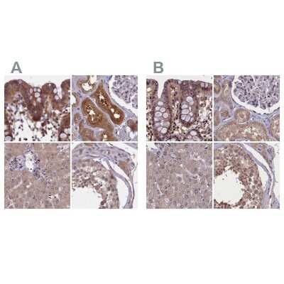 Immunohistochemistry-Paraffin: NUBP1 Antibody [NBP1-92204]