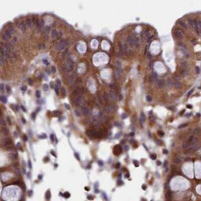 Immunohistochemistry-Paraffin: NUBP1 Antibody [NBP1-92204]