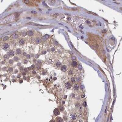 Immunohistochemistry-Paraffin: NUBP1 Antibody [NBP1-92204]