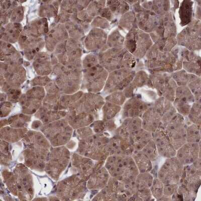 Immunohistochemistry-Paraffin: NUBP1 Antibody [NBP1-92205]