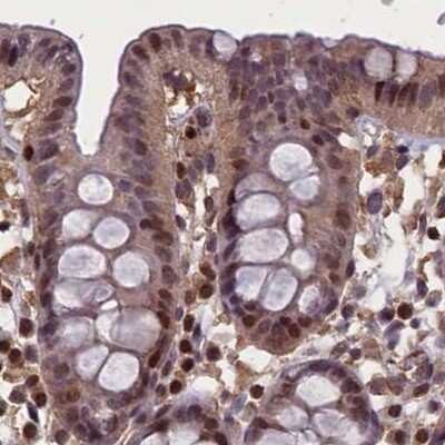 Immunohistochemistry-Paraffin: NUBP1 Antibody [NBP1-92205]