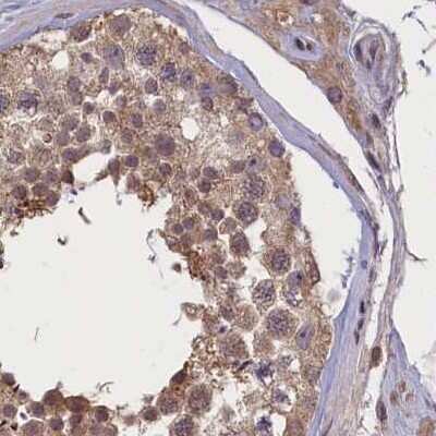 Immunohistochemistry-Paraffin: NUBP1 Antibody [NBP1-92205]