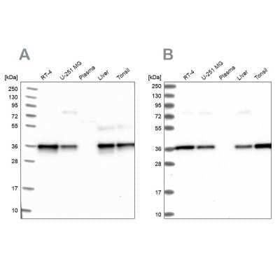 Western Blot: NUBP1 Antibody [NBP1-92205]