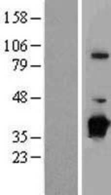 Western Blot: NUBP1 Overexpression Lysate [NBP2-08111]