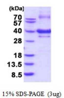 SDS-PAGE: Recombinant Human NUBP1 His Protein [NBP2-52049]