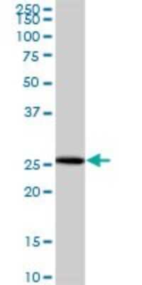 Western Blot: NUBP2 Antibody [H00010101-B01P]