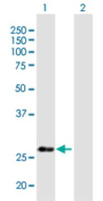 Western Blot: NUBP2 Antibody [H00010101-B01P]