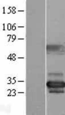 Western Blot: NUBP2 Overexpression Lysate [NBL1-13846]