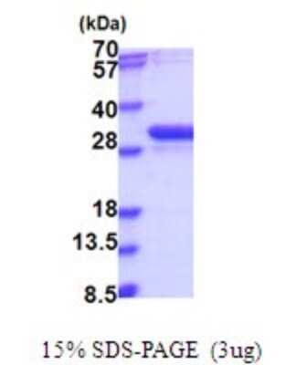 SDS-PAGE: Recombinant Human NUBP2 His Protein [NBP2-51904]