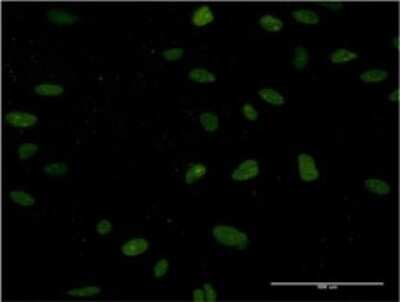 Immunocytochemistry/ Immunofluorescence: NUCKS1 Antibody (3G10) [H00064710-M02]