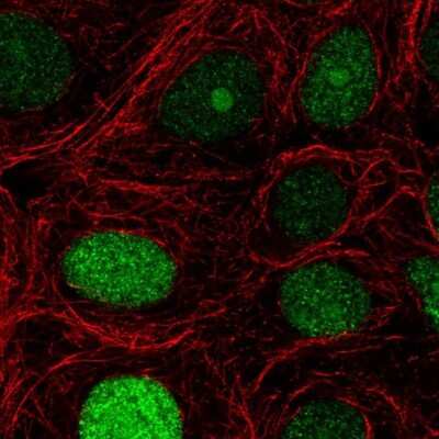 Immunocytochemistry/ Immunofluorescence: NUCKS1 Antibody [NBP2-49365]