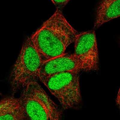 Immunocytochemistry/ Immunofluorescence: NUCKS1 Antibody [NBP2-56969]