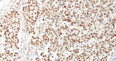 Immunohistochemistry: NUCKS1 Antibody [NB100-74634]