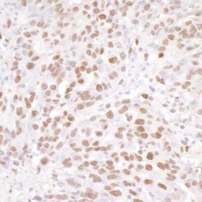 Immunohistochemistry-Paraffin: NUCKS1 Antibody [NB100-74635]