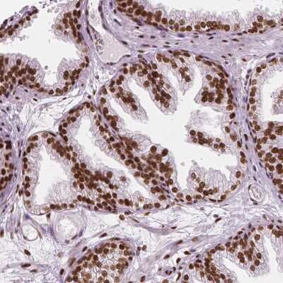 Immunohistochemistry-Paraffin: NUCKS1 Antibody [NBP2-49365]