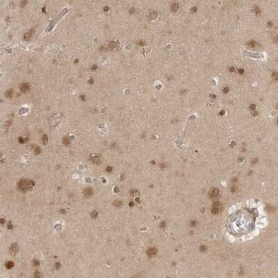 Immunohistochemistry-Paraffin: NUDC Antibody [NBP1-89510]