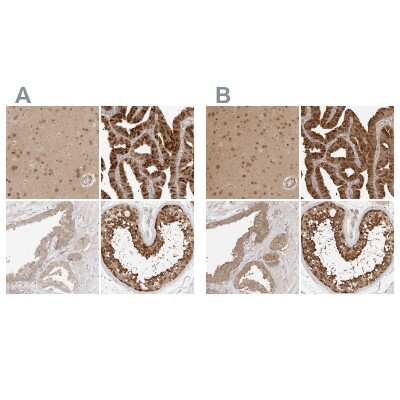 Immunohistochemistry-Paraffin: NUDC Antibody [NBP1-89510]