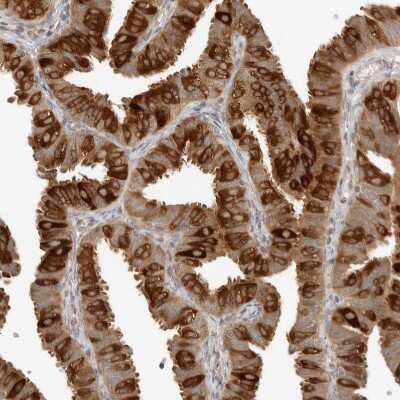 Immunohistochemistry-Paraffin: NUDC Antibody [NBP1-89510]