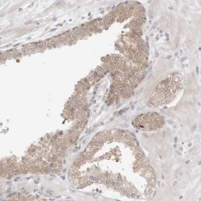 Immunohistochemistry-Paraffin: NUDC Antibody [NBP1-89510]