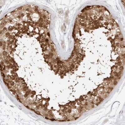 Immunohistochemistry-Paraffin: NUDC Antibody [NBP1-89510]