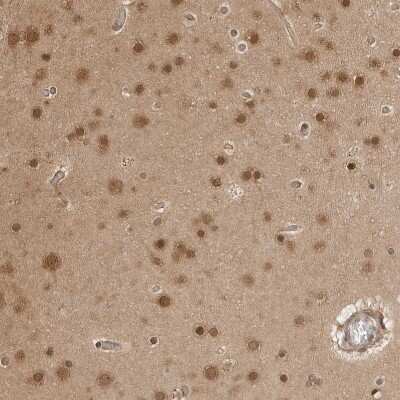 Immunohistochemistry-Paraffin: NUDC Antibody [NBP1-89517]