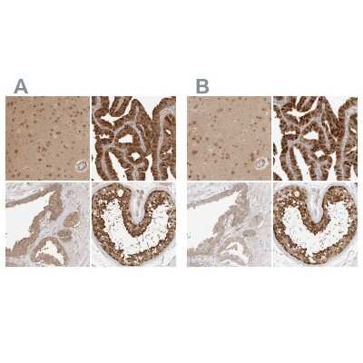 Immunohistochemistry-Paraffin: NUDC Antibody [NBP1-89517]