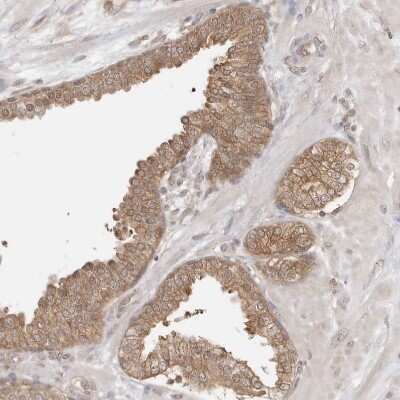 Immunohistochemistry-Paraffin: NUDC Antibody [NBP1-89517]