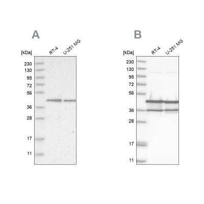 Western Blot: NUDC Antibody [NBP1-89510]